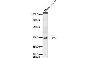 Western blot analysis of extracts of mouse kidney, using PIM1 antibody (ABIN6128456, ABIN6145654, ABIN6145656 and ABIN6218499) at 1:3000 dilution. (PIM1 antibody  (AA 1-313))