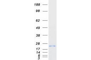 Validation with Western Blot