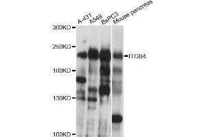 Western blot analysis of extracts of various cell lines, using ITGB4 antibody (ABIN5970319) at 1/1000 dilution. (Integrin beta 4 antibody)