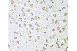 Immunohistochemistry of paraffin-embedded Mouse brain using TARS Polyclonal Antibody at dilution of 1:100 (40x lens).