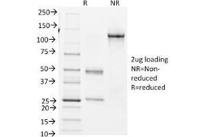 SDS-PAGE Analysis Purified BCL-6 Mouse Monoclonal Antibody (BCL6/1982). (BCL6 antibody  (AA 256-389))