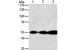 Western Blot analysis of Jurkat, Hela and A549 cell using GSR Polyclonal Antibody at dilution of 1:750 (Glutathione Reductase antibody)