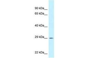 Image no. 1 for anti-Spi-C Transcription Factor (Spi-1/PU.1 Related) (SPIC) (AA 148-197) antibody (ABIN6747713) (SPIC antibody  (AA 148-197))