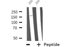 Western blot analysis of extracts from 293 cells, using ABCA6 antibody. (ABCA6 antibody  (Internal Region))