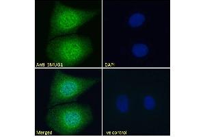 ABIN185204 Immunofluorescence analysis of paraformaldehyde fixed MCF7 cells, permeabilized with 0. (SMUG1 antibody  (N-Term))