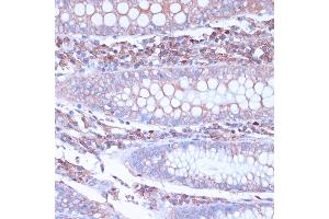 Immunohistochemistry of paraffin-embedded human colon using CD38 antibody (ABIN6130076, ABIN6138177, ABIN6138178 and ABIN6217677) at dilution of 1:100 (40x lens). (CD38 antibody  (AA 46-300))