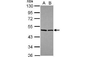 WB Image Sample (30 ug of whole cell lysate) A: Hela B: Hep G2 , 10% SDS PAGE antibody diluted at 1:10000 (EIF4A2 antibody)