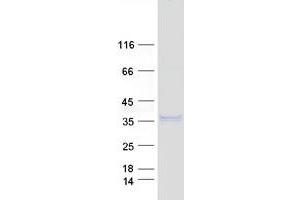 Validation with Western Blot (Nerve Growth Factor Protein (NGF) (Myc-DYKDDDDK Tag))