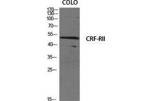 Western Blot (WB) analysis of specific cells using CRF-RII Polyclonal Antibody. (CRHR2 antibody  (Internal Region))
