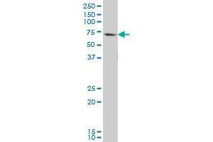 GATAD2B monoclonal antibody (M01), clone 4G10 Western Blot analysis of GATAD2B expression in Jurkat . (GATAD2B antibody  (AA 3-110))