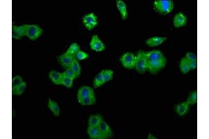 Immunofluorescence staining of HepG2 cells with ABIN7173829 at 1:200, counter-stained with DAPI. (TNFRSF1B antibody  (AA 56-210))