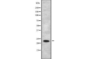 Western blot analysis of RRAS2 using HuvEc whole cell lysates (RRAS2 antibody  (C-Term))