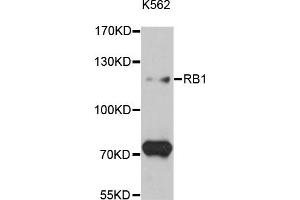 Western blot analysis of extracts of K-562 cells, using RB1 antibody (ABIN5995517) at 1:3000 dilution. (Retinoblastoma 1 antibody)