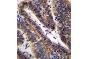 Immunohistochemistry analysis in formalin fixed and paraffin embedded human uterus tissue reacted with LRRN4CL Antibody (Center) followed which was peroxidase conjugated to the secondary antibody and followed by DAB staining. (LRRN4CL antibody  (Middle Region))
