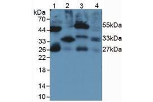 Figure. (IL-33 antibody  (AA 110-261))