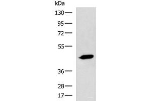 Western blot analysis of A431 cell lysate using ASB10 Polyclonal Antibody at dilution of 1:800 (ASB10 antibody)