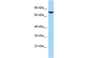 Host: Rabbit Target Name: AFAP1L1 Sample Type: Jurkat Whole Cell lysates Antibody Dilution: 1. (AFAP1L1 antibody  (C-Term))