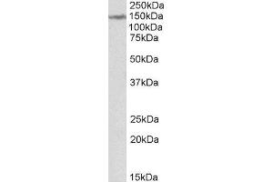 ABIN2563702 (2µg/ml) staining of Human Cerebellum lysate (35µg protein in RIPA buffer). (LMTK2 antibody  (Internal Region))