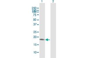 Western Blot analysis of UBE2V2 expression in transfected 293T cell line by UBE2V2 MaxPab polyclonal antibody. (UBE2V2 antibody  (AA 1-145))