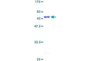 DCPS Protein (AA 1-337) (GST tag)