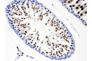 Immunohistochemistry (Paraffin-embedded Sections) (IHC (p)) image for anti-Cell Division Cycle 6 Homolog (S. Cerevisiae) (CDC6) (AA 147-549) antibody (ABIN3043500) (CDC6 antibody  (AA 147-549))