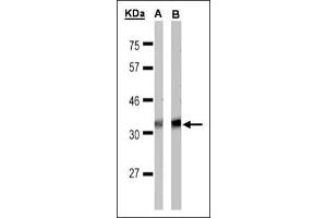 Western blot: Sample (30 µg of whole cell lysate).