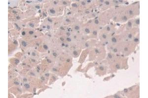 Detection of GCA in Human Liver Tissue using Polyclonal Antibody to Grancalcin (GCA) (Grancalcin antibody  (AA 1-139))