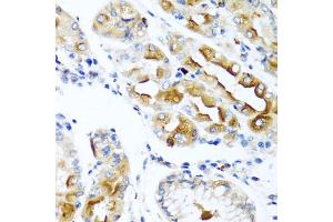 Immunohistochemistry of paraffin-embedded human stomach using CCL21 antibody. (CCL21 antibody)