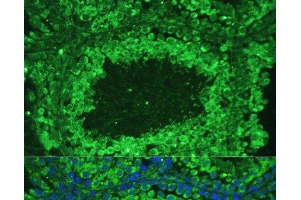 ASZ1 antibody