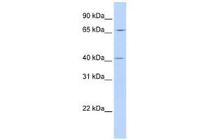 ASAP3 antibody used at 1 ug/ml to detect target protein. (ASAP3 antibody  (N-Term))