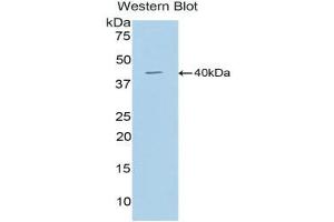 Western Blotting (WB) image for anti-Cathepsin D (CTSD) (AA 66-410) antibody (ABIN3206938) (Cathepsin D antibody  (AA 66-410))