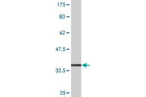 Western Blot detection against Immunogen (36. (DYRK4 antibody  (AA 421-520))