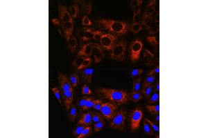 Immunofluorescence analysis of U-2 OS cells using HSPB8/HSP22 Rabbit mAb (ABIN6132943, ABIN6144482, ABIN6144483 and ABIN7101424) at dilution of 1:100 (40x lens). (HSPB8 antibody)