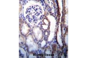 ATP6V1B1 Antibody (Center) immunohistochemistry analysis in formalin fixed and paraffin embedded human kidney tissue followed by peroxidase conjugation of the secondary antibody and DAB staining. (ATP6V1B1 antibody  (Middle Region))