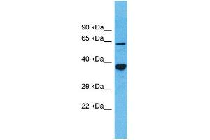 Western Blotting (WB) image for anti-Olfactory Receptor, Family 5, Subfamily D, Member 13 (OR5D13) (C-Term) antibody (ABIN2791752) (OR5D13 antibody  (C-Term))