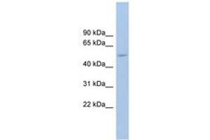 Image no. 1 for anti-Ankyrin Repeat Domain 13 Family, Member D (ANKRD13D) (AA 518-567) antibody (ABIN6745108) (ANKRD13D antibody  (AA 518-567))