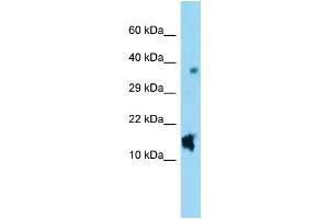 WB Suggested Anti-Nppc Antibody Titration: 1. (NPPC antibody  (C-Term))