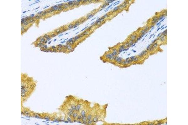 BTD antibody