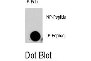 Image no. 1 for anti-Mitogen-Activated Protein Kinase Kinase Kinase Kinase 4 (MAP4K4) (pSer629) antibody (ABIN358366) (MAP4K4 antibody  (pSer629))