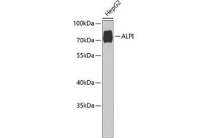 Western blot analysis of extracts of HepG2 cells, using ALPI Antibody (ABIN6127419, ABIN6136822, ABIN6136823 and ABIN6221820) at 1:1000 dilution. (Intestinal Alkaline Phosphatase antibody  (AA 20-240))