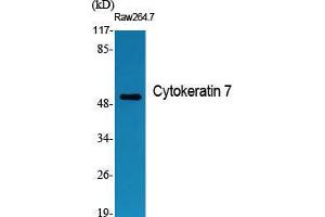 Western Blot (WB) analysis of specific cells using Cytokeratin 7 Polyclonal Antibody. (Cytokeratin 7 antibody  (C-Term))