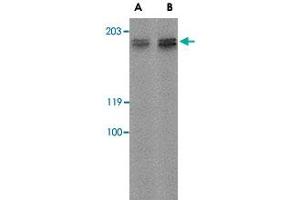 Western blot analysis of GPR124 in rat kidney tissue lysate with GPR124 polyclonal antibody  at (A) 2 ug/mL and (B) 4 ug/mL . (GPR124 antibody  (Internal Region))