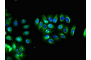 Immunofluorescent analysis of A549 cells using ABIN7158320 at dilution of 1:100 and Alexa Fluor 488-congugated AffiniPure Goat Anti-Rabbit IgG(H+L) (LHFPL5 antibody  (AA 46-99))