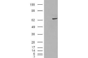 Western Blotting (WB) image for Insulin-Like Growth Factor 2 mRNA Binding Protein 2 (IGF2BP2) peptide (ABIN369348)