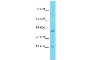 Western Blotting (WB) image for anti-SH2 Domain Containing 1A (SH2D1A) (Middle Region) antibody (ABIN2505365) (SH2D1A antibody  (Middle Region))