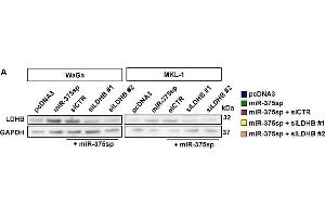 LDHB plays dual roles in MCPyV+ and MCPyV- MCC cells. (LDHB antibody  (AA 1-334))