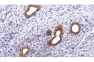 Immunohistochemistry (IHC) image for anti-Keratin 5 (KRT5) (AA 335-473) antibody (ABIN7437212)