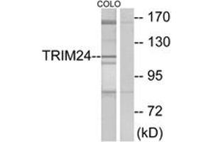 Western blot analysis of extracts from COLO cells, using TRIM24 Antibody. (TRIM24 antibody  (AA 1001-1050))