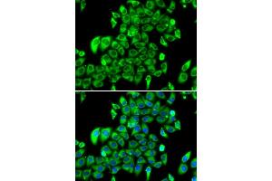 Immunofluorescence analysis of MCF7 cell using RPL13 antibody.