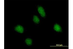 Immunofluorescence of purified MaxPab antibody to REPS1 on HeLa cell. (REPS1 antibody  (AA 1-653))